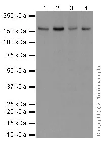 Western blot - Anti-FANCA/FAA antibody [EPR16519-42] - BSA and Azide free (AB251345)