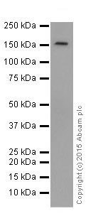 Western blot - Anti-FANCA/FAA antibody [EPR16519] (AB201457), expandable thumbnail