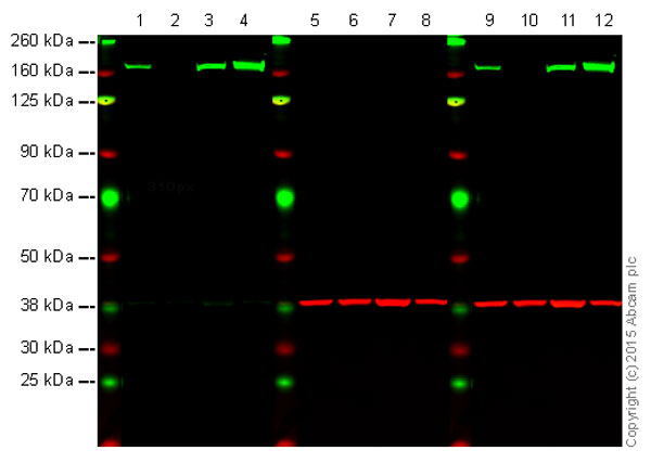 Western blot - Anti-FANCA/FAA antibody [EPR16519] (AB201457), expandable thumbnail