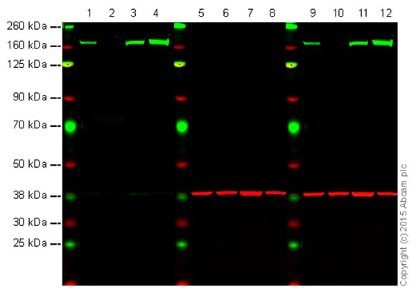 Western blot - Anti-FANCA/FAA antibody [EPR16519] (AB201457)