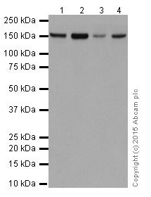 Western blot - Anti-FANCA/FAA antibody [EPR16519] (AB201457), expandable thumbnail