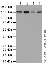 Western blot - Anti-FANCA/FAA antibody [EPR16519] (AB201457)