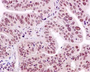 Immunohistochemistry (Formalin/PFA-fixed paraffin-embedded sections) - Anti-FANCB antibody [EPR15513] - BSA and Azide free (AB243941)