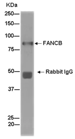Immunoprecipitation - Anti-FANCB antibody [EPR15513] - BSA and Azide free (AB243941)
