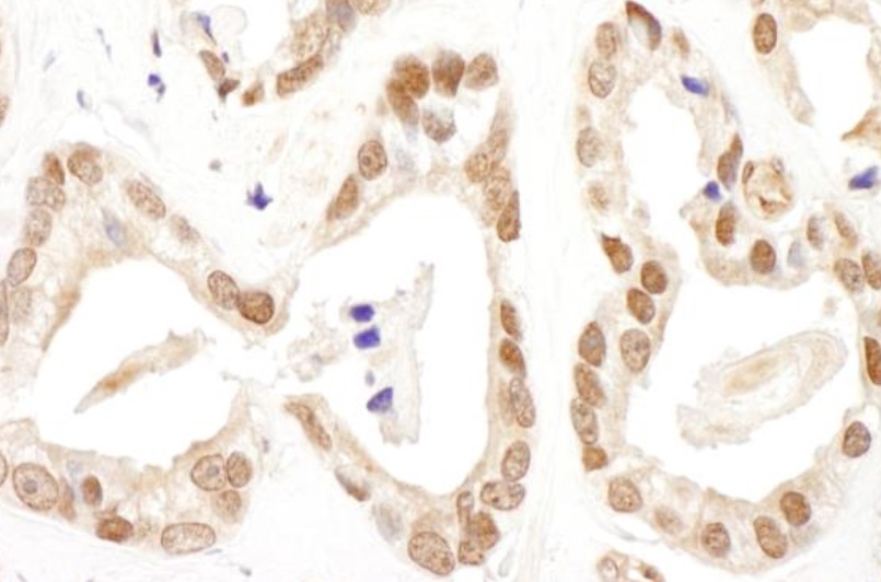 Immunohistochemistry (Formalin/PFA-fixed paraffin-embedded sections) - Anti-FANCD2 antibody (AB245347)