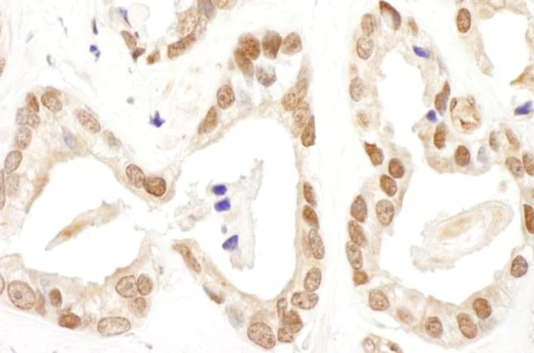 Immunohistochemistry (Formalin/PFA-fixed paraffin-embedded sections) - Anti-FANCD2 antibody (AB245347)