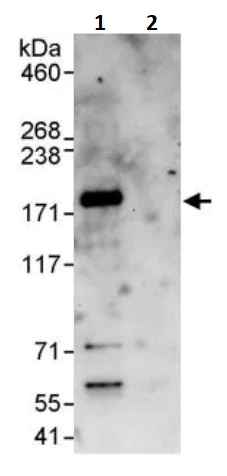 Immunoprecipitation - Anti-FANCD2 antibody (AB245347)