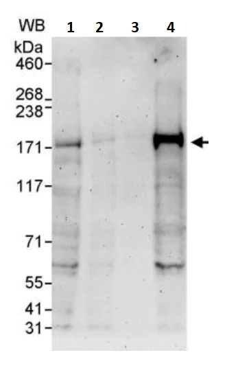 Western blot - Anti-FANCD2 antibody (AB245347)