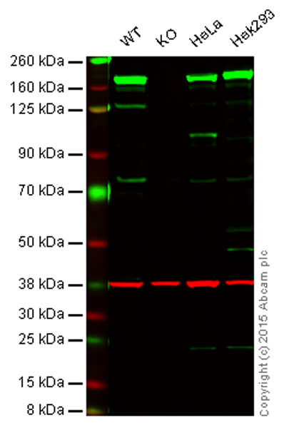 Western blot - Anti-FANCD2 antibody [EPR2279(3)] (AB178705), expandable thumbnail