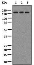 Western blot - Anti-FANCD2 antibody [EPR2279(3)] (AB178705), expandable thumbnail