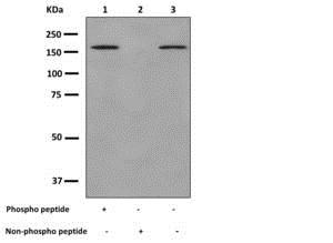 Western blot - Anti-FANCD2 antibody [EPR2279(3)] (AB178705), expandable thumbnail
