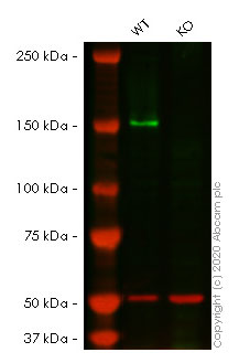 Western blot - Anti-FANCD2 antibody [EPR2279(3)] (AB178705), expandable thumbnail