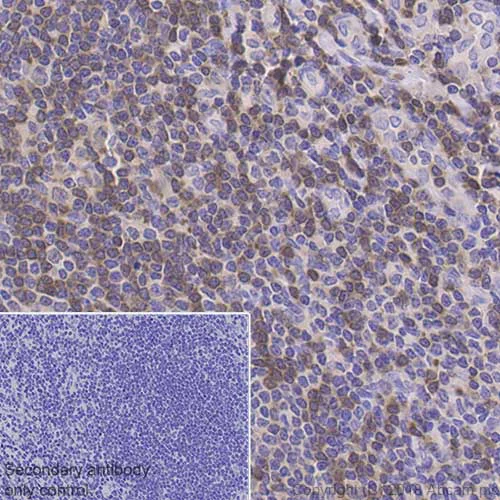 Immunohistochemistry (Formalin/PFA-fixed paraffin-embedded sections) - Anti-FANCD2 antibody [EPR2302] (AB108928)