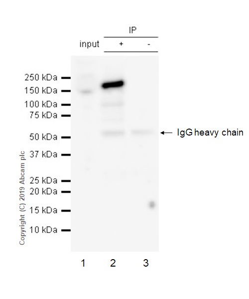 Anti-FANCD2 antibody [EPR2302] KO tested (ab108928) | Abcam