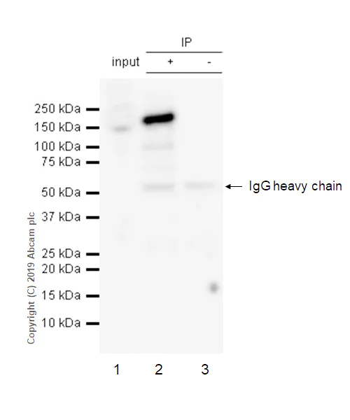 Immunoprecipitation - Anti-FANCD2 antibody [EPR2302] (AB108928)