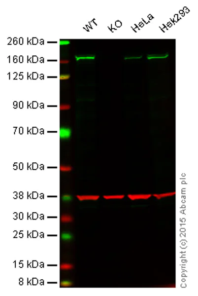 Western blot - Anti-FANCD2 antibody [EPR2302] (AB108928)