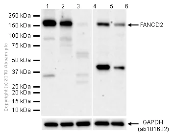 Western blot - Anti-FANCD2 antibody [EPR2302] (AB108928)