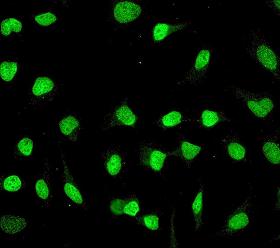 Immunocytochemistry/ Immunofluorescence - Anti-FANCD2 antibody [EPR2302] - BSA and Azide free (ab221932), expandable thumbnail