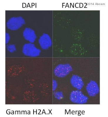 Immunocytochemistry/ Immunofluorescence - Anti-FANCD2 antibody [EPR2302] - BSA and Azide free (ab221932), expandable thumbnail