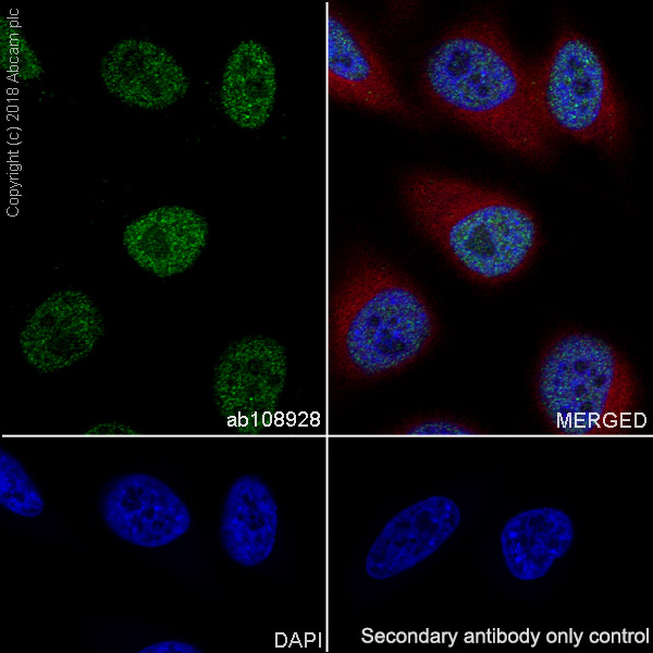 Immunocytochemistry/ Immunofluorescence - Anti-FANCD2 antibody [EPR2302] - BSA and Azide free (ab221932), expandable thumbnail