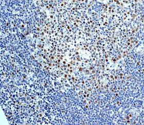 Immunohistochemistry (Formalin/PFA-fixed paraffin-embedded sections) - Anti-FANCD2 antibody [EPR2302] - BSA and Azide free (AB221932)