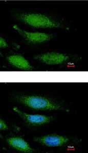 Immunocytochemistry/ Immunofluorescence - Anti-FANCG antibody (AB151516)