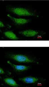 Immunocytochemistry/ Immunofluorescence - Anti-FANCG antibody (AB151516)