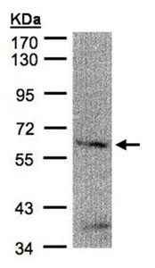 Western blot - Anti-FANCG antibody (AB151516)