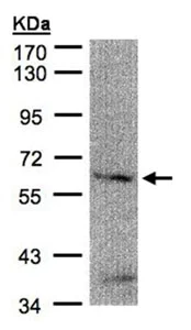 Western blot - Anti-FANCG antibody (AB151516)