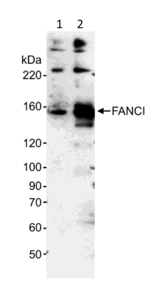 Western blot - Anti-FANCI antibody (AB15344)