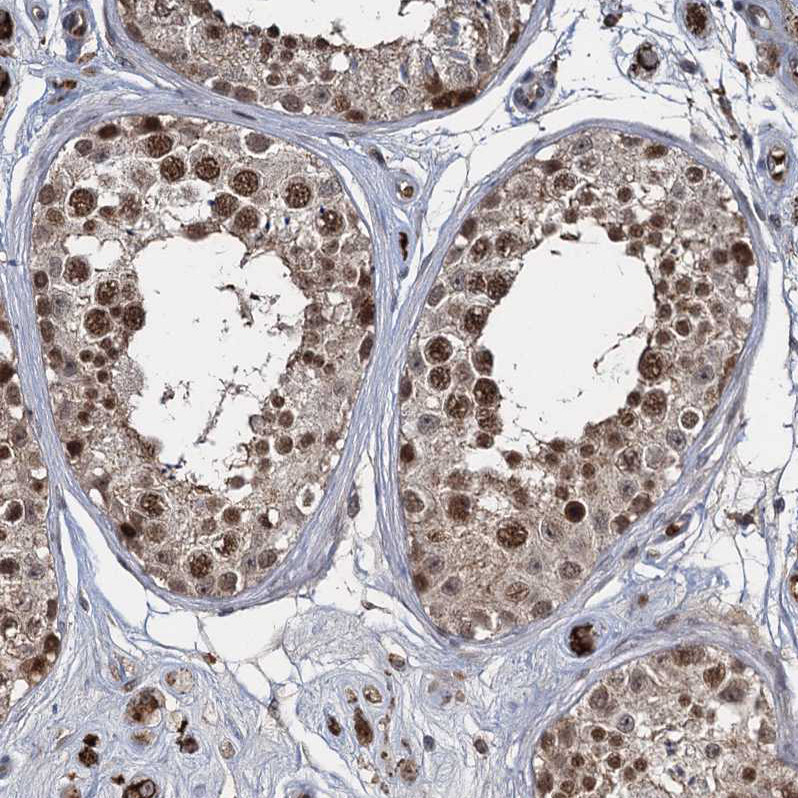 Immunohistochemistry (Formalin/PFA-fixed paraffin-embedded sections) - Anti-FANCI antibody (AB243420), expandable thumbnail