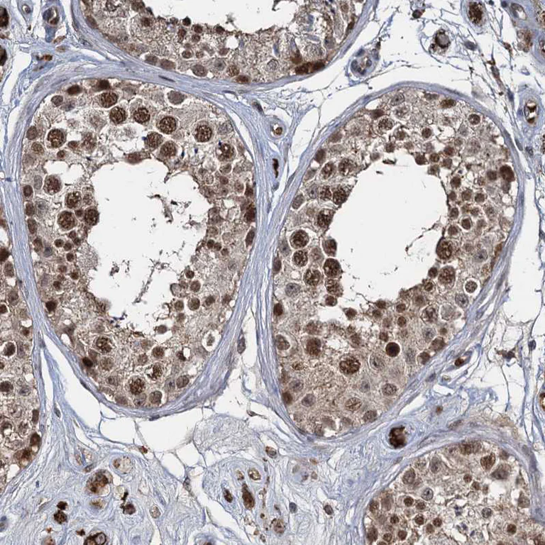 Immunohistochemistry (Formalin/PFA-fixed paraffin-embedded sections) - Anti-FANCI antibody (AB243420)