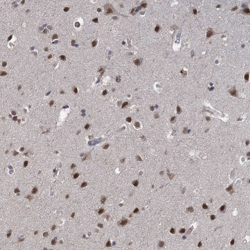Immunohistochemistry (Formalin/PFA-fixed paraffin-embedded sections) - Anti-FANCI antibody (AB243420), expandable thumbnail