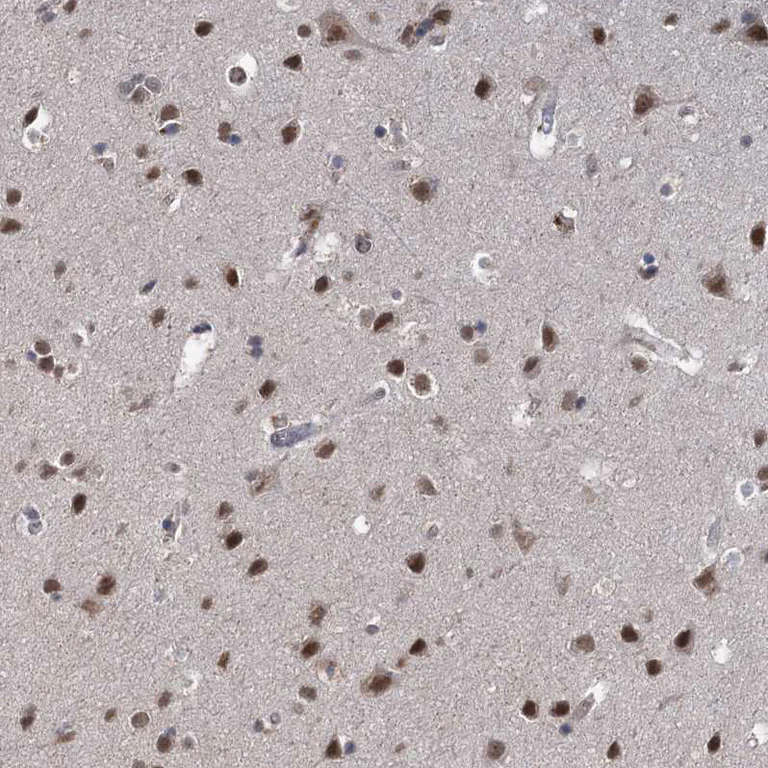 Immunohistochemistry (Formalin/PFA-fixed paraffin-embedded sections) - Anti-FANCI antibody (AB243420)