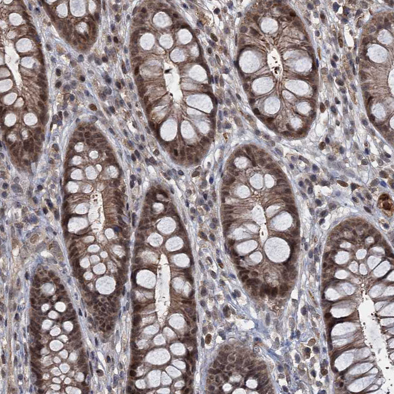 Immunohistochemistry (Formalin/PFA-fixed paraffin-embedded sections) - Anti-FANCI antibody (AB243420), expandable thumbnail