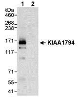Immunoprecipitation - Anti-FANCI antibody (AB74332)