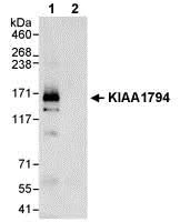 Immunoprecipitation - Anti-FANCI antibody (AB74332)