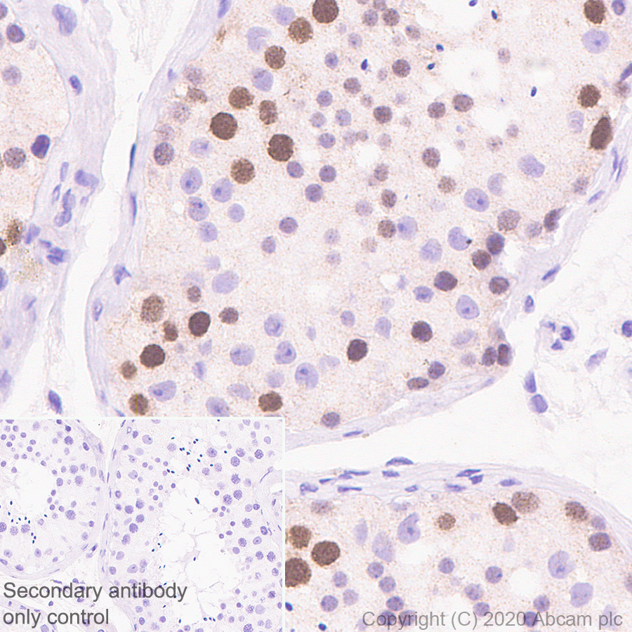Immunohistochemistry (Formalin/PFA-fixed paraffin-embedded sections) - Anti-FANCI antibody [EPR23903-124] (ab245219), expandable thumbnail