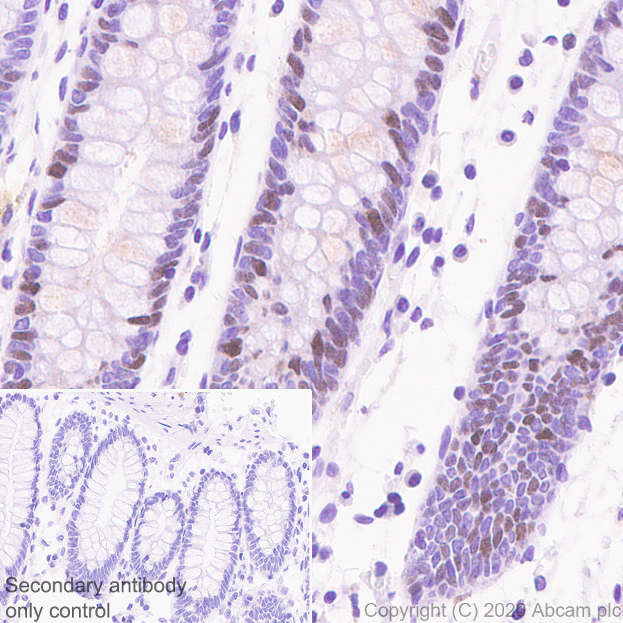 Immunohistochemistry (Formalin/PFA-fixed paraffin-embedded sections) - Anti-FANCI antibody [EPR23903-124] (ab245219), expandable thumbnail