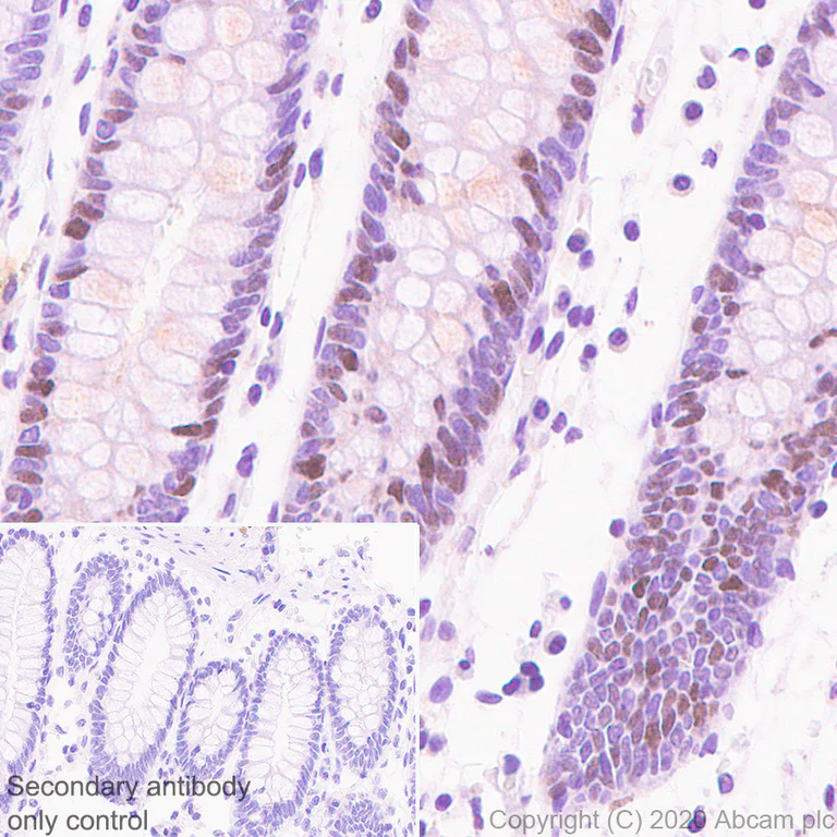 Immunohistochemistry (Formalin/PFA-fixed paraffin-embedded sections) - Anti-FANCI antibody [EPR23903-124] (AB245219)