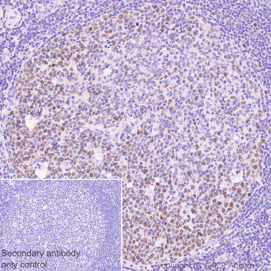 Immunohistochemistry (Formalin/PFA-fixed paraffin-embedded sections) - Anti-FANCI antibody [EPR23903-124] (AB245219), expandable thumbnail