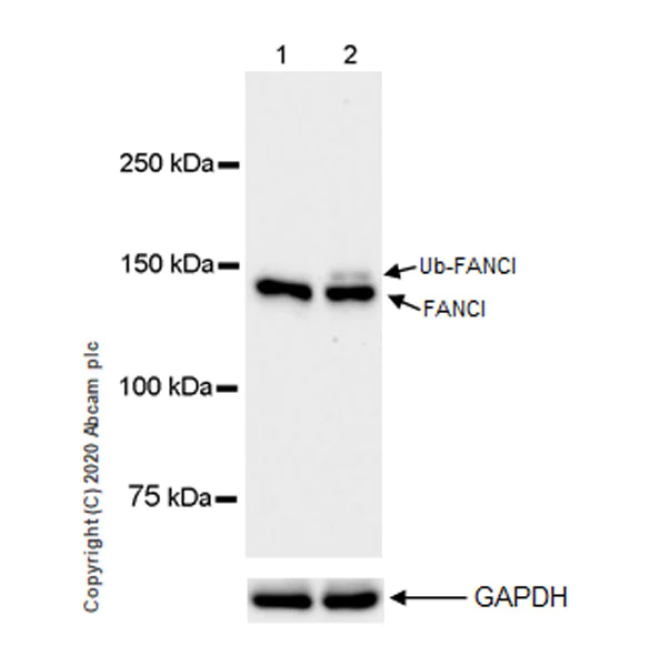 Western blot - Anti-FANCI antibody [EPR23903-124] (AB245219)