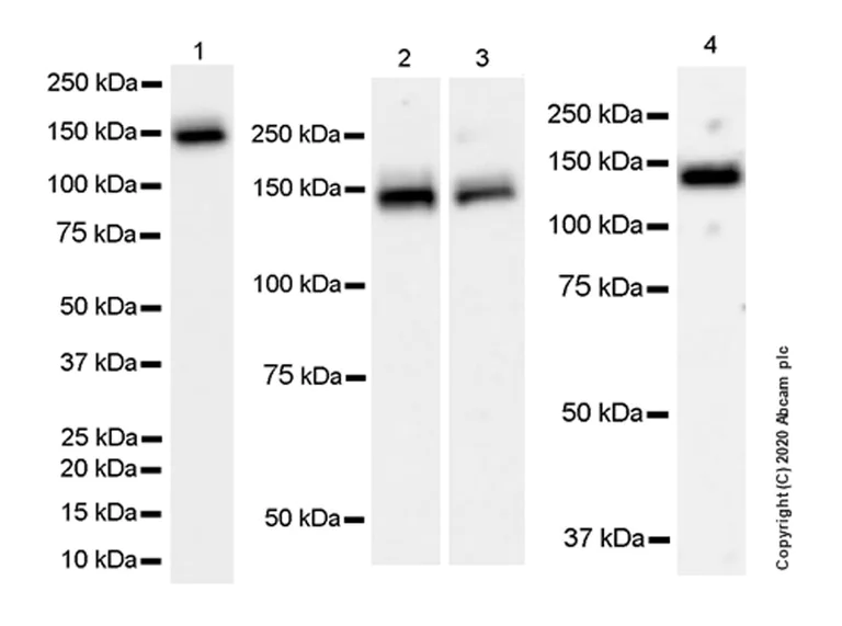 Western blot - Anti-FANCI antibody [EPR23903-124] (AB245219)