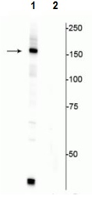 Western blot - Anti-FANCI (phospho S556) antibody (AB228516), expandable thumbnail