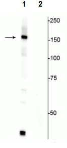 Western blot - Anti-FANCI (phospho S556) antibody (AB228516)