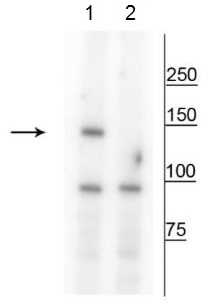 Western blot - Anti-FANCI (phospho S559) antibody (AB228518), expandable thumbnail