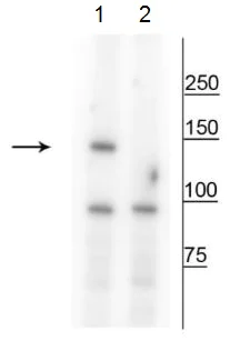 Western blot - Anti-FANCI (phospho S559) antibody (AB228518)