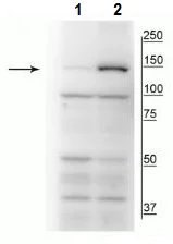 Western blot - Anti-FANCI (phospho S559) antibody (AB228518)