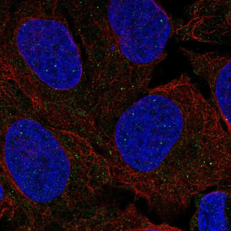 Immunocytochemistry/ Immunofluorescence - Anti-FANCL antibody (AB272618)