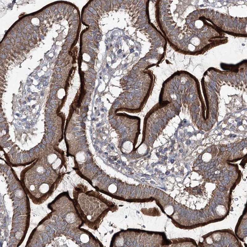Immunohistochemistry (Formalin/PFA-fixed paraffin-embedded sections) - Anti-FANCL antibody (AB272618), expandable thumbnail